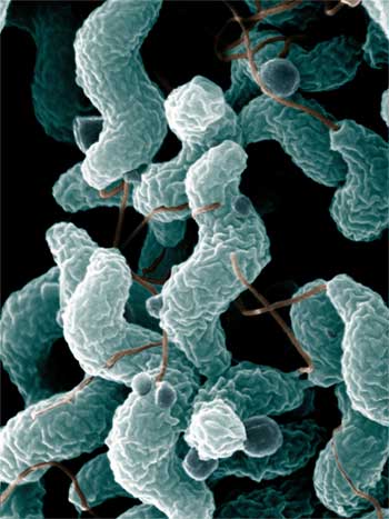 Так под микроскопом выглядит опасная бактерия Campylobacter